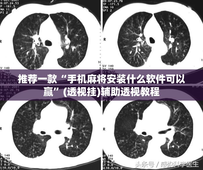 推荐一款“手机麻将安装什么软件可以赢”(透视挂)辅助透视教程
