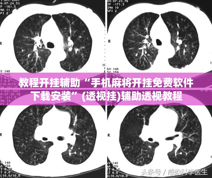 教程开挂辅助“手机麻将开挂免费软件下载安装”(透视挂)辅助透视教程