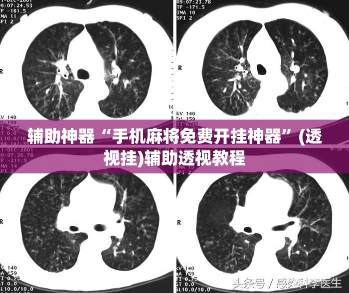 辅助神器“手机麻将免费开挂神器”(透视挂)辅助透视教程