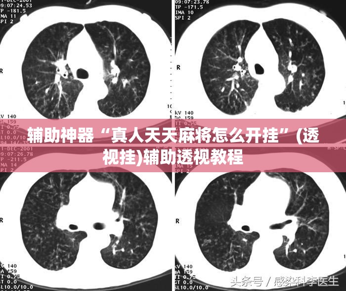 辅助神器“真人天天麻将怎么开挂”(透视挂)辅助透视教程