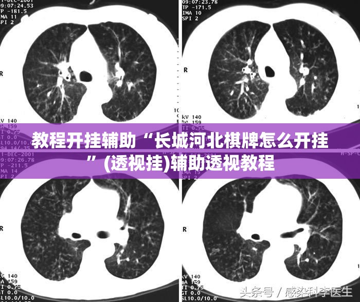 教程开挂辅助“长城河北棋牌怎么开挂”(透视挂)辅助透视教程