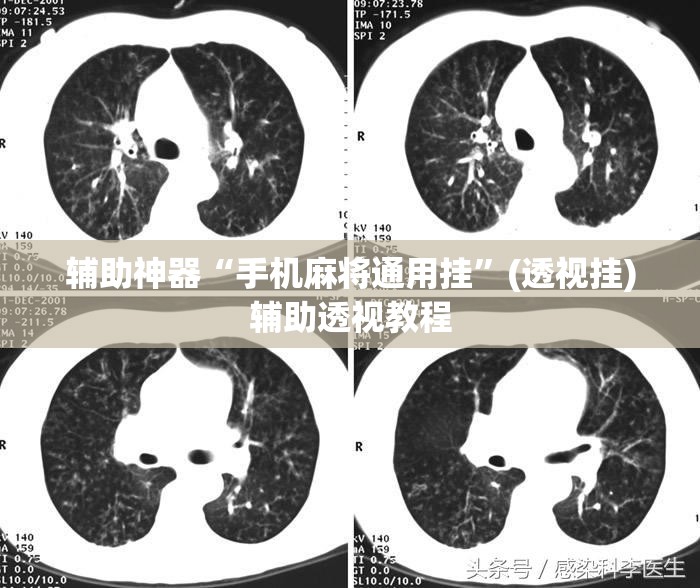 辅助神器“手机麻将通用挂”(透视挂)辅助透视教程