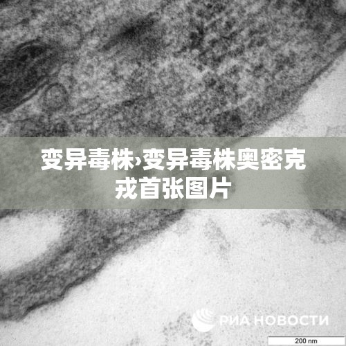 变异毒株›变异毒株奥密克戎首张图片