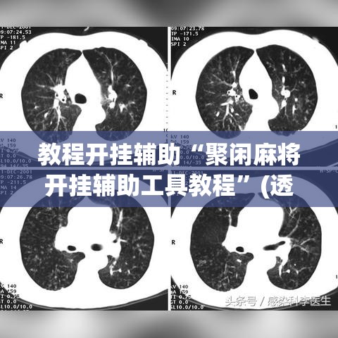 教程开挂辅助“聚闲麻将开挂辅助工具教程”(透视挂)辅助透视教程