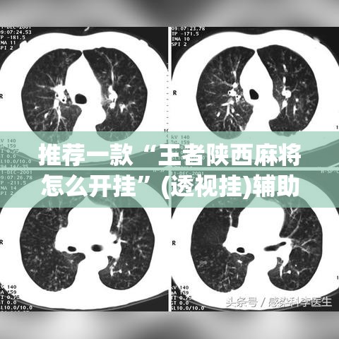 推荐一款“王者陕西麻将怎么开挂”(透视挂)辅助透视教程