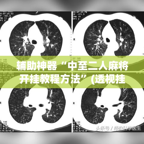 辅助神器“中至二人麻将开挂教程方法	”(透视挂)辅助透视教程