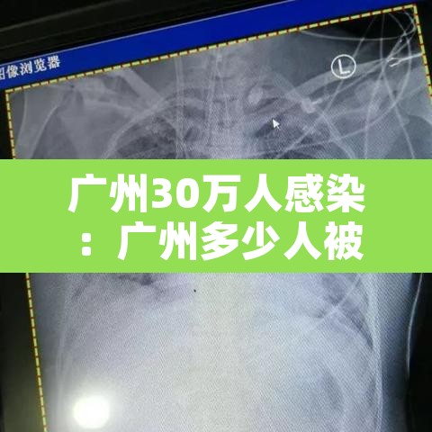 广州30万人感染：广州多少人被感染