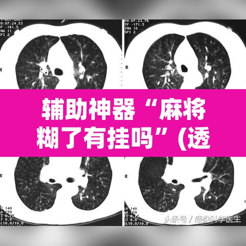 辅助神器“麻将糊了有挂吗	”(透视挂)辅助透视教程