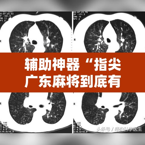 辅助神器“指尖广东麻将到底有没有挂”(透视挂)辅助透视教程