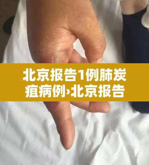 北京报告1例肺炭疽病例›北京报告1例肺炭疽病例活动轨迹