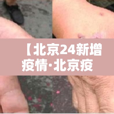 【北京24新增疫情·北京疫情 24日】