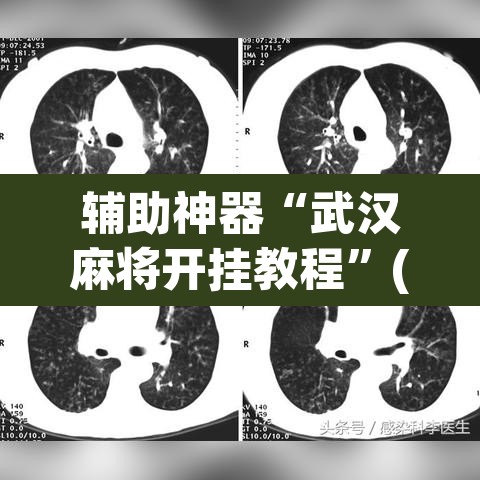 辅助神器“武汉麻将开挂教程”(透视挂)辅助透视教程