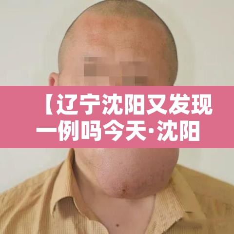 【辽宁沈阳又发现一例吗今天·沈阳发现一例疫情】 【辽宁沈阳又发现一例吗今天·沈阳发现一例疫情】