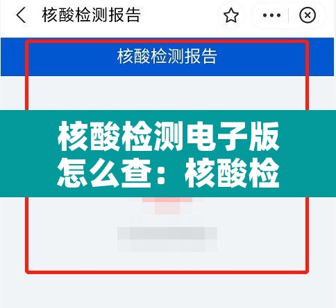 核酸检测电子版怎么查：核酸检测电子版咋查