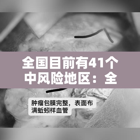 全国目前有41个中风险地区:全国目前有83个中风险地区 全国目前有41个中风险地区:全国目前有83个中风险地区