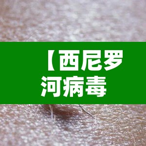 【西尼罗河病毒,西尼罗河病毒是什么】